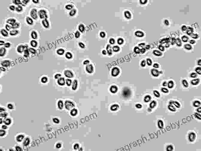 Microscopic Image Of Yeast Cells Yeast And No Yeast Fast Bread Recipes For Newbies At Home Show Your Own Bakery With This Bread Baking Bible